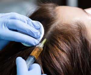 mesoterapia-capelli-tricologia